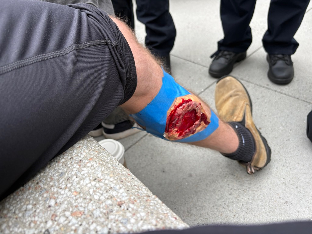 I was playing a patient with a gunshot wound to the calf. Shoutout to the makeup team (and sorry for the gore).